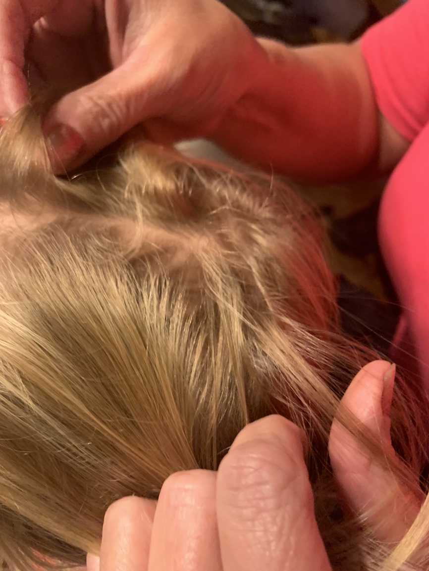 Greenville, South Carolina Head lice treatment & Mobile (inhome